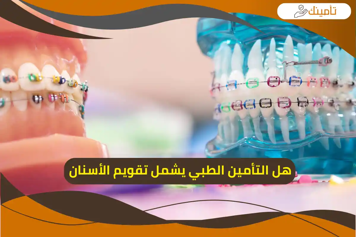 هل التأمين الطبي يشمل تقويم الأسنان