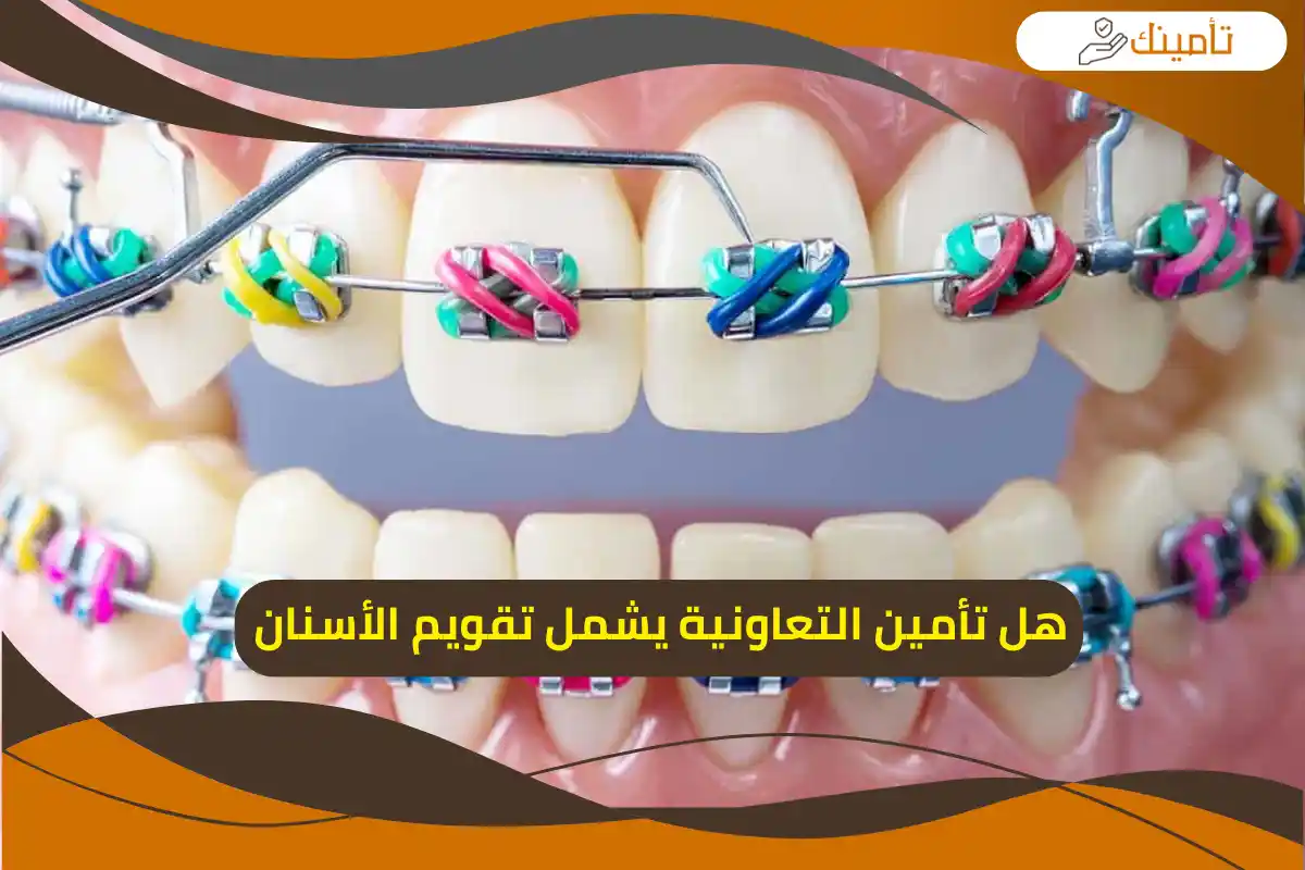 هل تأمين التعاونية يشمل تقويم الأسنان